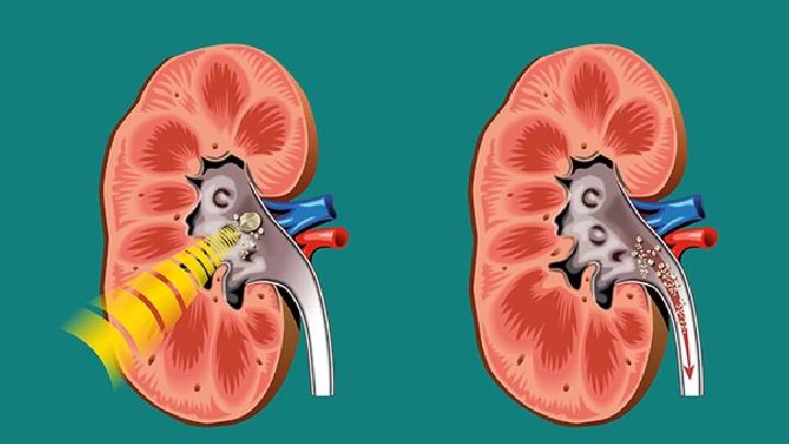 男性腎虛可以吃什么給你推薦五款壯陽養(yǎng)腎粥