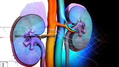 非淋菌性尿道炎能治愈吗 非淋菌性尿道炎常见的治疗方法有3种