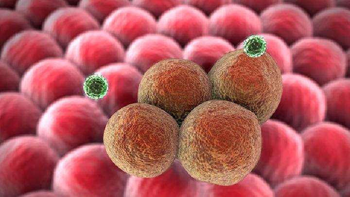 玫瑰糠疹与梅毒怎么鉴别关于玫瑰糠疹与梅毒的4个知识点