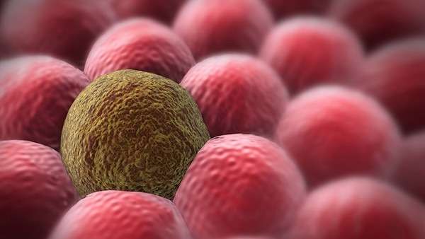 癌细胞竟然可以在体内养70年！