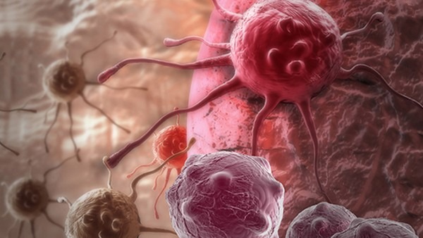肿瘤细胞的驱动突变，麻省理工科学家发明癌症驱动的突变挖掘算法