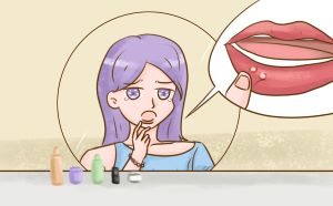 保持口腔卫生对治疗口腔溃疡重要吗？