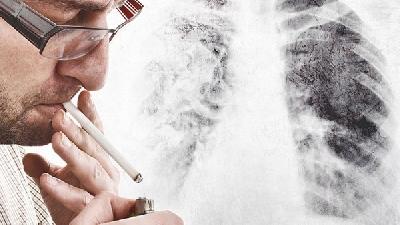 肺癌早期要注意哪些常見的癥狀 肺癌早期常見這3種癥狀