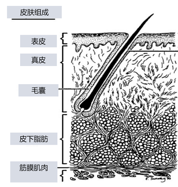 怎么区分后背的痘痘是不是毛囊炎？两方面来鉴别