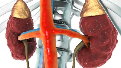 遗传性肾炎能活多久 遗传性肾炎的相关疾病常识