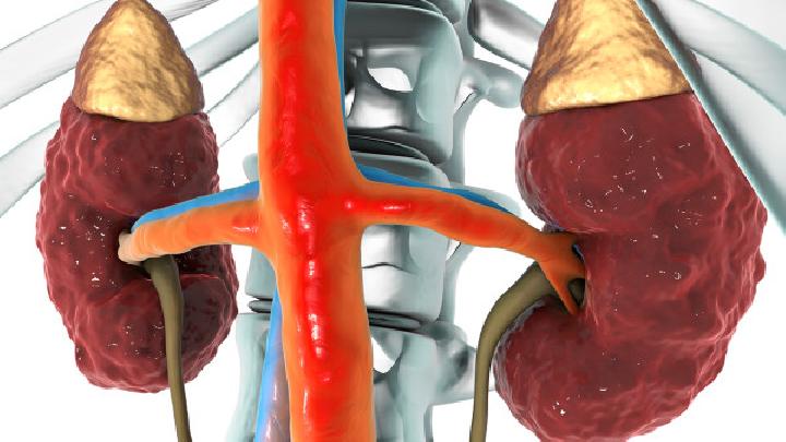 女性腎盂腎炎早期有什么癥狀女性腎盂腎炎的4個(gè)早期癥狀