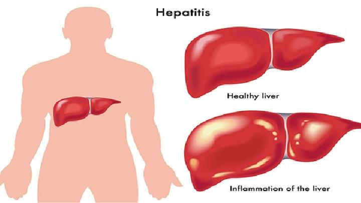 丙肝患者饮食吃什么好？5种适合丙肝吃的食物