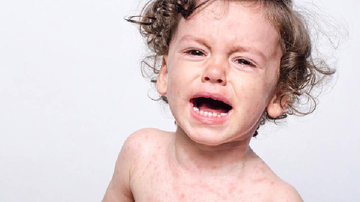 怎样预防儿童患上哮喘？3种介绍帮你预防儿童哮喘