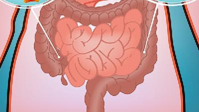 直肠癌禁止吃什么肉？直肠癌避免食用腌制及熏烤的肉类