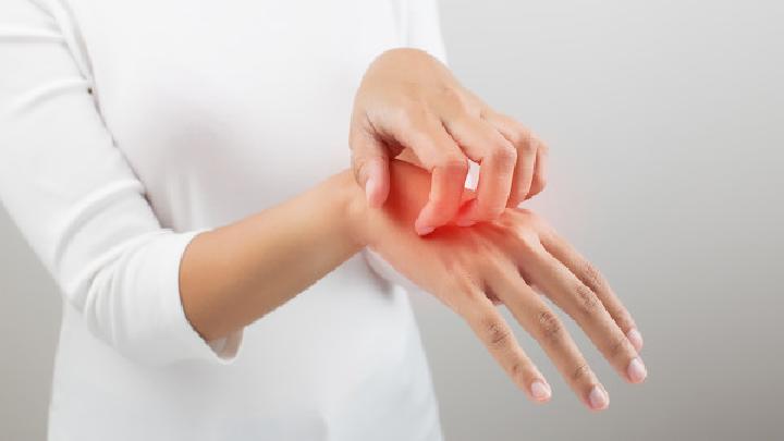 皮肌炎是什么症状？皮肌炎是什么病严重吗？