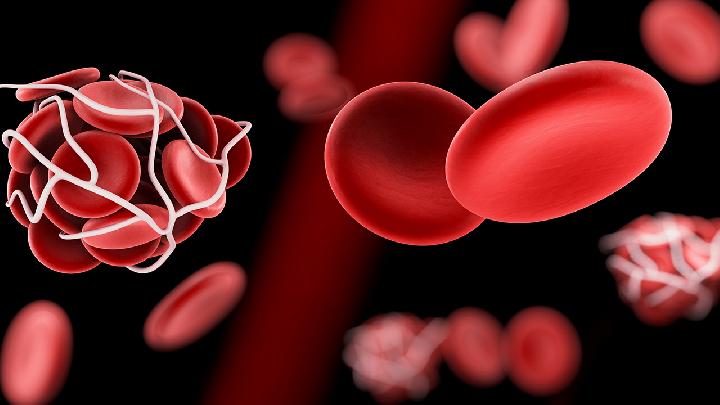 慢性粒细胞白血病能治好吗？慢性粒细胞白血病能活多少年？