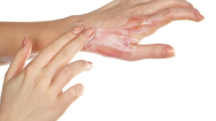 皮肤纤维瘤治疗的最佳方法是什么？皮肤纤维瘤会癌变吗？