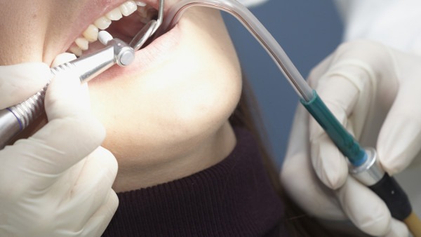 爱护牙齿 保护乳牙健康一定要做好这三部