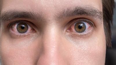 治疗角膜炎什么方法比较好？生理盐水洗眼睛有用吗