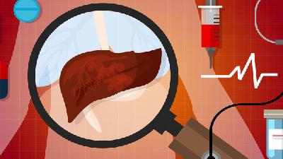 到底脂肪肝是怎么回事？5原因容易引发脂肪肝