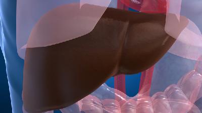 脂肪肝的错误认知都有哪些 预防脂肪肝饮食要注意5点