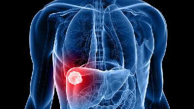 柚子皮可以治疗肝炎吗？感染乙型肝炎病毒后常分为4种类型