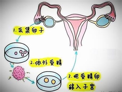 飞华首页 飞华新闻 医疗资讯 济南红会医院 人工授精和自然受孕率差不