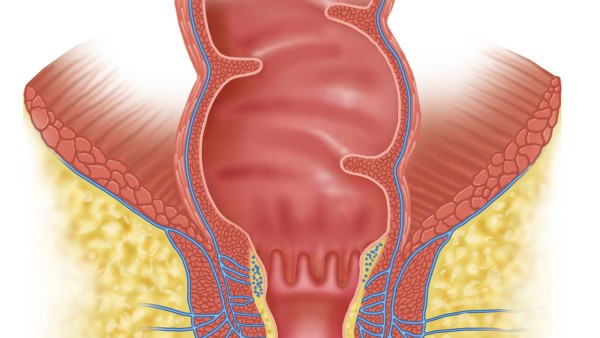 白塞氏病患者忌盲目用药