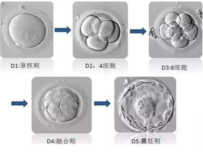 子宫偏小可以做试管婴儿吗?