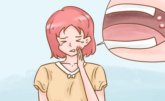 這就詳細(xì)為您介紹口腔潰瘍的類型和發(fā)病原因吧