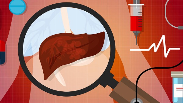 得了脂肪肝应该如何预防 甩掉脂肪肝危害的五大措施