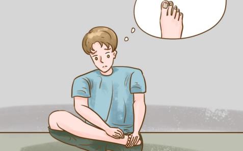鳞屑角化型脚气灰指甲怎么治疗？