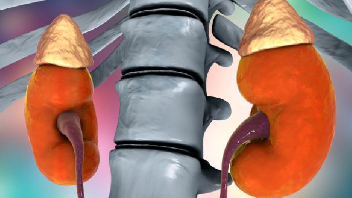 肾结石是什么原因造成的注意这些易导致肾结石的因素
