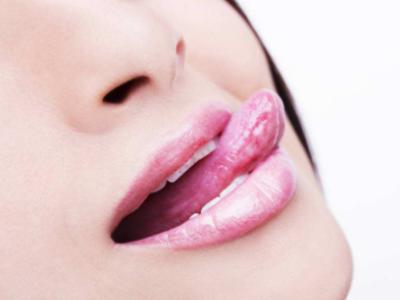 舌炎症状不同而且分类不同