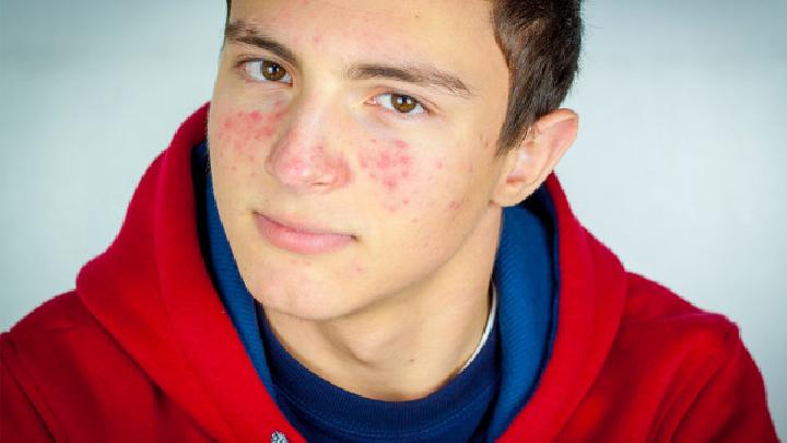 青春痘疤痕有哪些类型？青春痘疤痕怎么办？