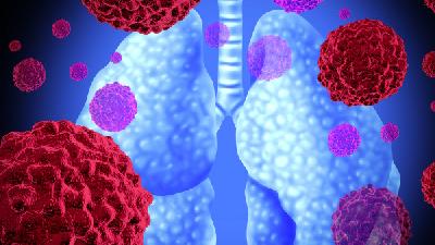 日常该如何预防肺癌 预防肺癌要远离这5种气