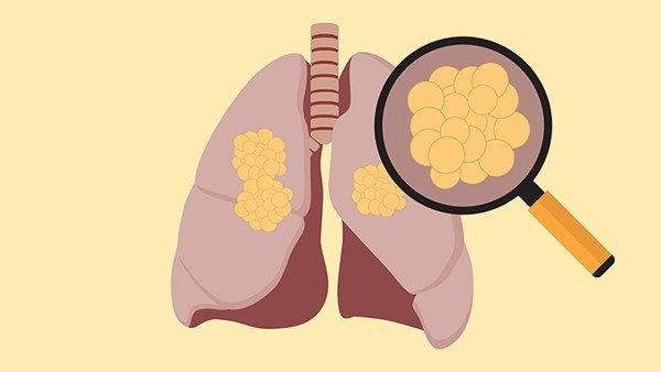 解热消炎胶囊治疗新型冠状病毒肺炎的药理特点，加强抗病毒功能