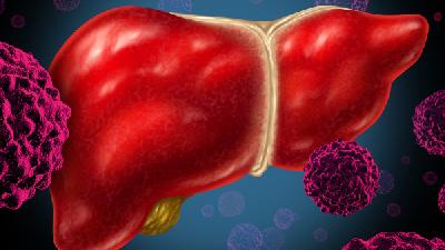 日常该如何预防肝癌 预防肝癌提倡三查二早