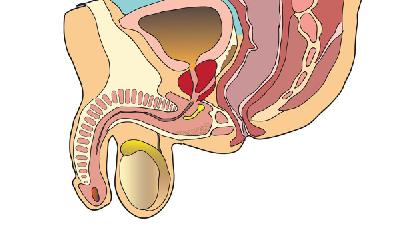 男性不育症的治疗原则 导致男性不育的6大原因