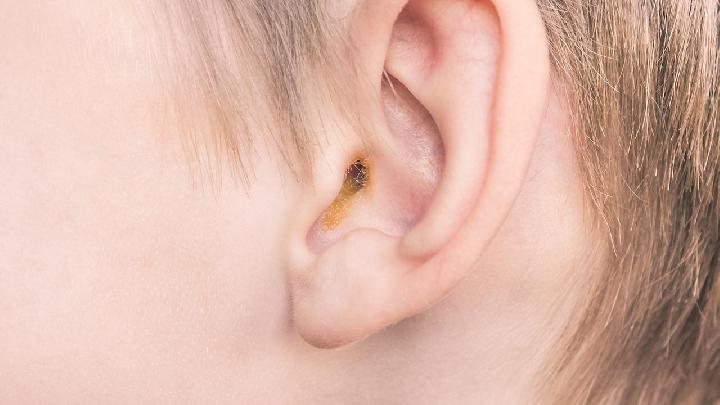 中耳炎不同类型的食疗方中耳炎的三大症状解析
