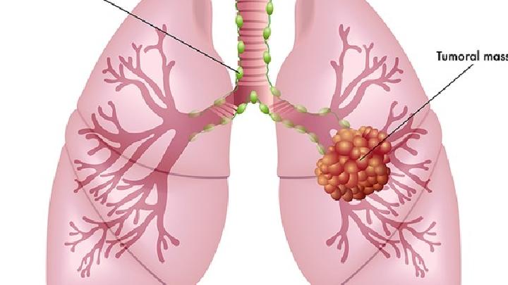 兒童感冒小心會引起肺炎兒童感冒的常見表現(xiàn)分析