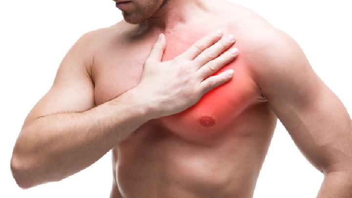 红斑狼疮心肌炎症状是什么红斑狼疮早期的表现