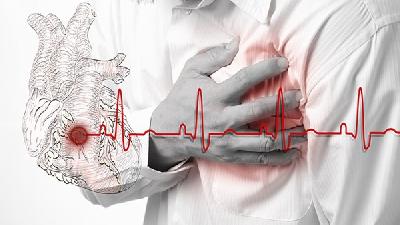 心绞痛药物怎么分类？心绞痛药物主要有2种类型