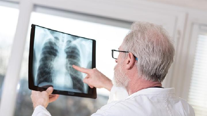 强化ct能检查肺栓塞吗细数肺栓塞的检查方法有哪些