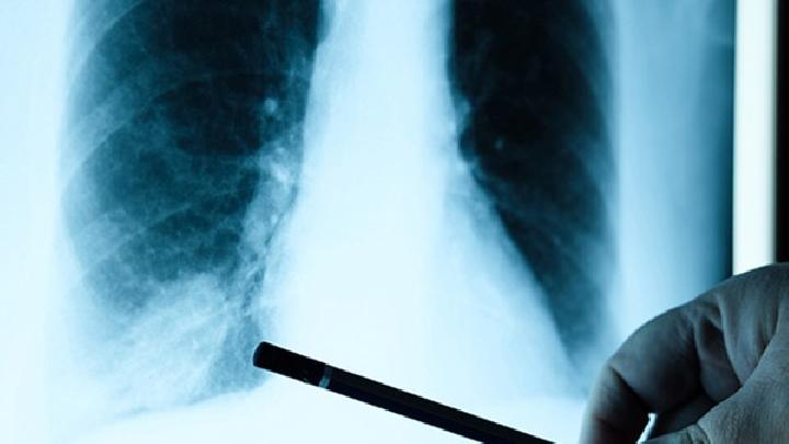 肺栓塞治疗的办法有哪些肺栓塞的表现及症状有哪些