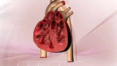 心绞痛预防措施是怎样的 患者应了解变异性心绞痛的6大特点