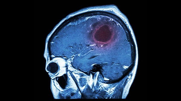脑灵素片鉴别方法及疗效介绍 脑灵素片的疗效怎么样