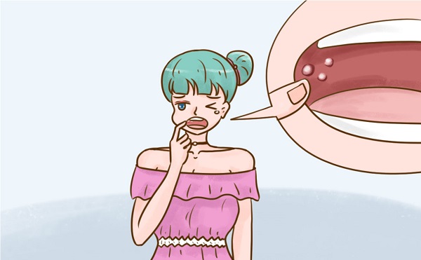 你知道口腔溃疡是怎么引起的吗？