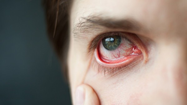 龙泽熊胆胶囊和盐酸环丙沙星片可以治疗红眼病吗?