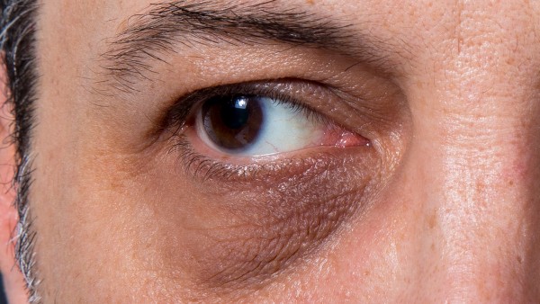 冰珍清目滴眼液能长期使用吗 冰珍清目滴眼液有副作用吗