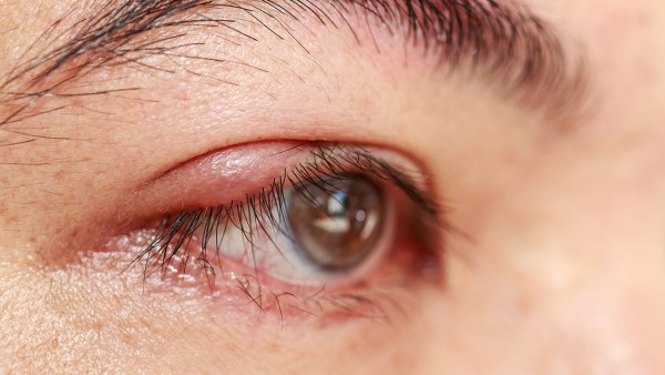 盐酸丙美卡因滴眼液可以用多长时间   可以长期使用吗