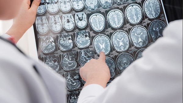 强力脑清素片主要用于哪些病症的 强力脑清素片的适应症