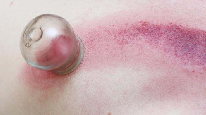 结节性痒疹的症状特点有哪些结节性痒疹的治疗方法是什么