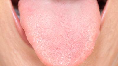 舌舔皮炎怎么治疗好 舌舔皮炎的表现是什么呢