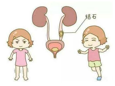 怎么造成的肾衰竭 o4YBAFywQFWAQ-OTAABPziSfUlE918.jpg